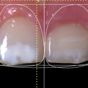 esthetische-tandheelkunde140.jpg