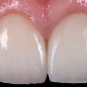 esthetische-tandheelkunde142.jpg
