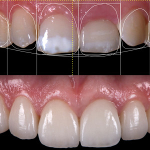 esthetische-tandheelkunde147.jpg